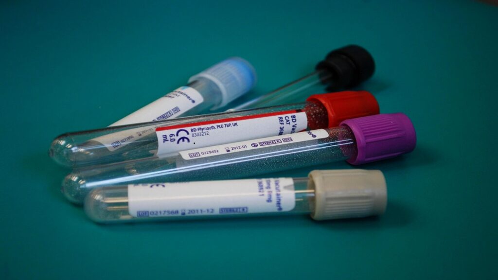 병원에서 진행하는 대상포진 검사 종류와 과정 설명