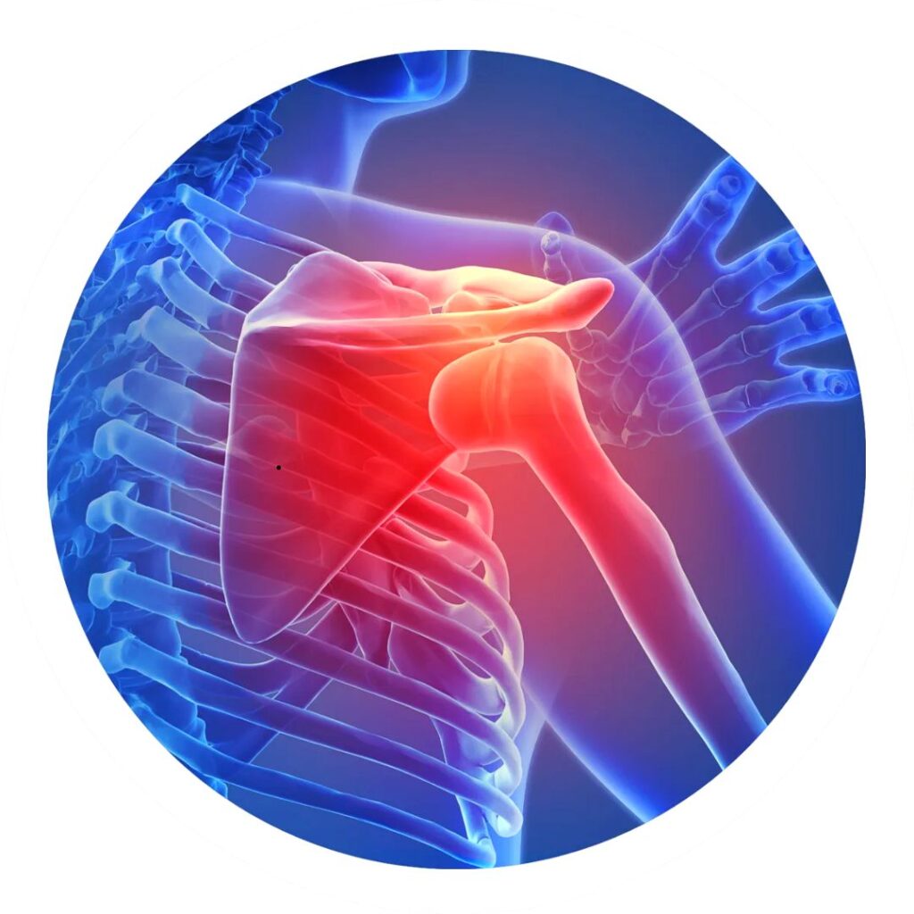 오십견 체외충격파 비용의 병원급별 차이와 비급여 진료비 확인법 안내